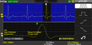 The above picture shows the split screen feature of the LeCroy WaveAce 1002. Top: Full signal (Heartbeat), Bottom: Zoomed in on QRS complex